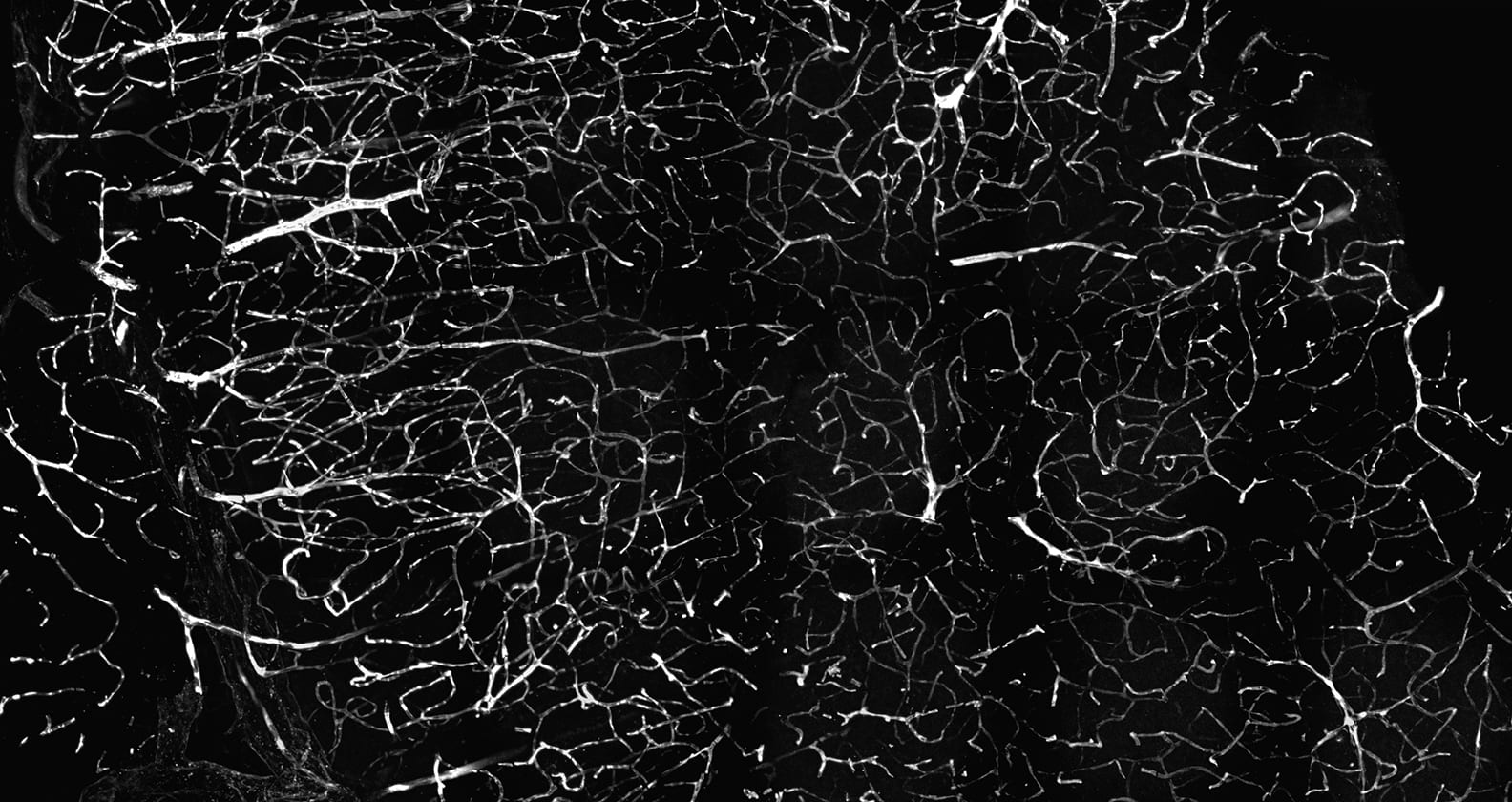 Image for Measuring leakage through the blood-brain barrier